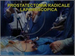 Video "Prostatectomia radicale laparoscopica"